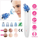 Electronic Blackhead Remover Vacuum Suction Facial Acne Pore Cleaner Blackhead Extractor Tool Device with 4 Heads