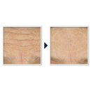 RoC Face & Neck Anti-Aging Moisturizer Firming Cream for Crepey Skin 1.7 fl oz - Imperfect Box