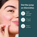 Hero Mighty Patch Micropoint for Blemishes 8ct - Imperfect Box