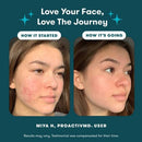 Proactiv MD 30 Day Acne Treatment Kit 3pc EXP 11/2026 - Imperfect Box