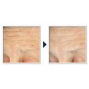 RoC Face & Neck Anti-Aging Moisturizer Firming Cream for Crepey Skin 1.7 fl oz - Imperfect Box