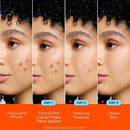 Biore Paint & Peel Liquid Pimple Patch Acne Spot Treatment with Salicylic Acid 0.50oz - Imperfect Box
