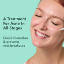 Rael Miracle Clear Complete Acne Treatment Face Serum 1oz - New