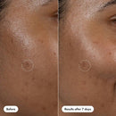 Hero Cosmetics Dark Spot Correct 10ml - New