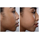 Spa Sciences SIMA Dermaplaning Replacement Safety Tips 6ct - New