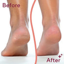 Finishing Touch Flawless Pedi - Imperfect Box