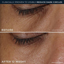 RoC Derm Correxion Dark Circle Eye Repair Cream 15ml - Missing Box