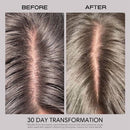 Jupiter Anti-Dandruff Restoring Scalp Serum 2.1 fl oz - New