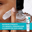 CeraVe Acne Control Foaming Face Cleanser 10% BPO 5 fl oz - Missing Box