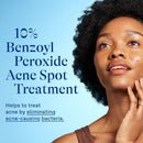 Differin 10% Benzoyl Peroxide Acne Spot Treatment - Imperfect Box