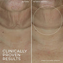 RoC Derm Correxion Retinol Face Stick - Imperfect Box