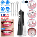 Portable Water Dental Flosser Cordless Rechargeable Dental Oral Irrigator IPX7 Waterproof Teeth Cleaner with 4 Modes 4 Nozzles 10.15oz Detachable Wate