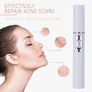 Blue Light Acne Laser Pen