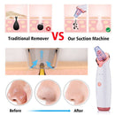 Electric Blackhead Suction Facial Washing Instrument