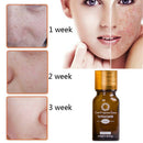 "Dredge Meridian Essence Oil