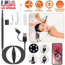 Ear Endoscope Wax Remover Tool HD Remover Ear Pick Camera Otoscope Cleaner Spoon with 6Pcs LED Lights
