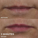 RoC Derm Correxion Lip Volumizer Treatment 0.34 fl oz - Imperfect Box