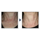 RoC Face & Neck Anti-Aging Moisturizer Firming Cream for Crepey Skin 1.7 fl oz - Imperfect Box