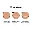 Hero Mighty Patch Chin 10ct - Imperfect Box