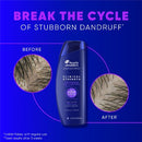 Head & Shoulders Clinical Strength Anti-Dandruff Citrus 13.5 fl oz - Imperfect Container