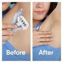 Venus Extra Smooth Sensitive Value Pack Women's Razor + 3 Razor Blade Refills - Imperfect Box