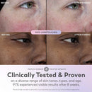 Olay Super Face Serum with Vitamin C 1 fl oz - Imperfect Box