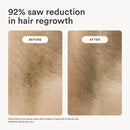 Nood The Flasher 2.0 IPL Permanent Hair Removal - Imperfect Box