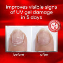 essie Nail Care To The Rescue UV Gel Damage Repair Nail Repair Treatment 0.46 fl oz - Imperfect Box