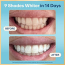Lumineux Tooth Whitening Strips 14pk - Imperfect Box