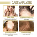 EELHOE Rosemary Essential Oil For Hair Care, Gentle And Nourishing Hair Care Oil